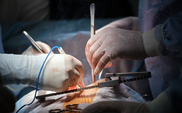 Cirugía de nervios pélvicos