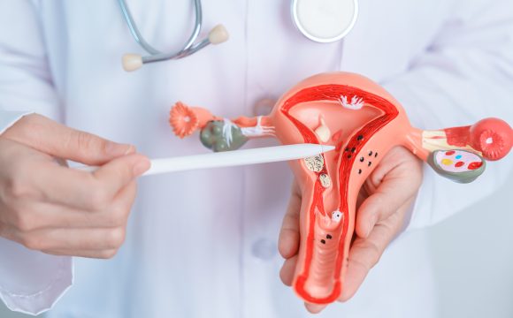 Ginecología oncológica