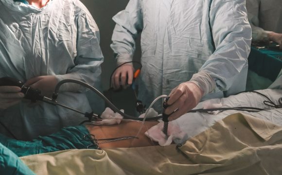 Histerectomía laparoscópica